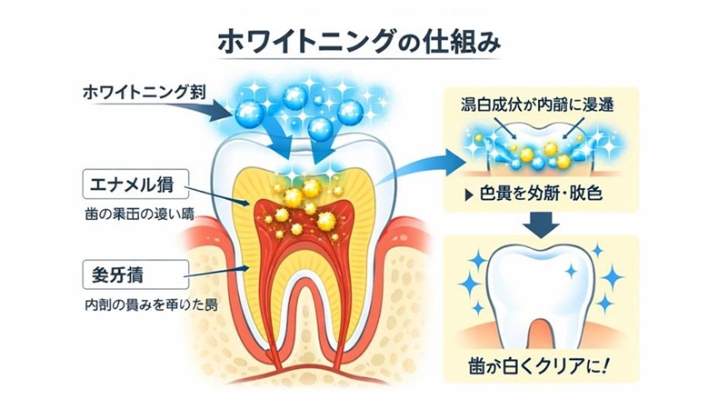 ホワイトニングの仕組み（歯の断面図・エナメル質と象牙質の解説イメージ）